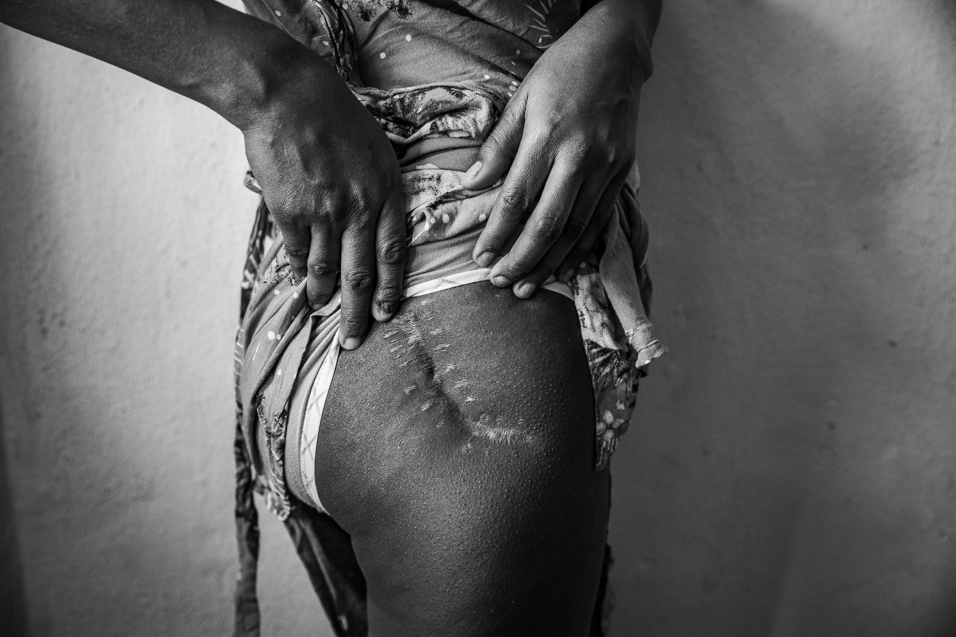 Women’s Bodies as Battlefields